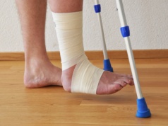 Czym się różni zwichnięcie od skręcenia? Jak leczyć zwichnięcie kostki, barku i nadgarstka?