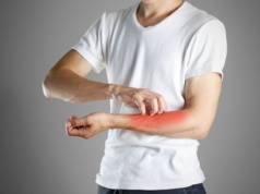 Świerzb ludzki - drogi zakażenia, przyczyny, objawy, diagnostyka i leczenie. Jak można zakazić się świerzbowcem?