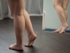 Choroby żylne nóg to nie kwestia estetyczna, a realny problem zdrowotny!