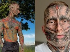 Pokrył tatuażami całe ciało, teraz relacjonuje proces ich USUWANIA. Różnicę widać gołym okiem: "Oto efekty po ROKU" (FOTO)