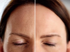 Ten krem to "dźwig" na opadającą powiekę. Unosi, napina i wyraźnie odmładza