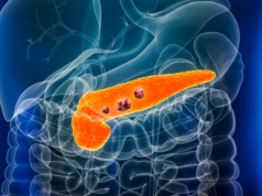 Odkryli, jak zmusić raka trzustki do kapitulacji. Rewolucyjna terapia