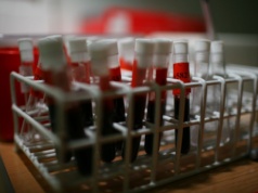 Wiele osób popełnia błąd przed badaniem krwi. Wyniki mogą wyjść nieprawidłowe