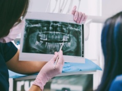 Zęby z Rzeszowa. Dlaczego Brytyjczycy i Skandynawowie leczą się na Podkarpaciu?