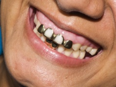 Użyteczni idioci Kremla