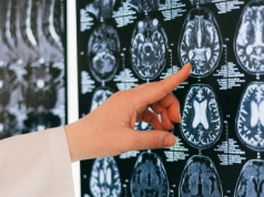 Gdy jeden skan zastępuje dwa. 3D, które może skrócić drogę do decyzji