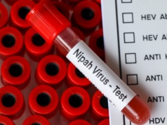 Nipah – kolejny wirus nietoperzy