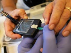 Jak obniżyć wysoki cholesterol? Lekarka zdradziła naturalny sposób