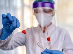 Niebezpieczny wirus Nipah