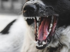 Pies pogryzł 11-latkę. Jest akt oskarżenia