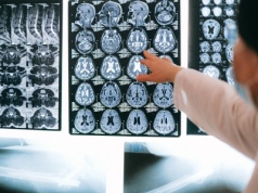 Na badanie rezonansem trzeba oczekiwać tak długo, że można… umrzeć