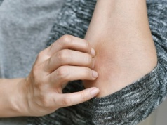 To częsty objaw niedoboru witaminy C. Odpowiada nie tylko za odporność