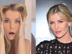 Joanna Krupa twierdzi, że zabiegi laserowe ZNISZCZYŁY jej cerę. "Uciekajcie od tego. To jest MASAKRA"