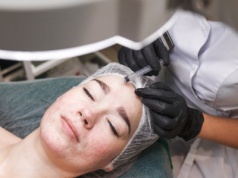 Medycyna estetyczna: Ministerstwo nie pozostawia złudzeń, kto może wykonywać te zabiegi