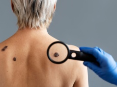 Łódzki NFZ organizuje darmowe badania skóry