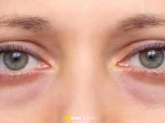 Ten krem usuwa zmarszczki i cienie pod oczami jak laser. "Odzyskałam młode spojrzenie"