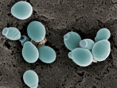 C. albicans powoduje, że czerniak jest bardziej złośliwy. Opisano mechanizm jego działania