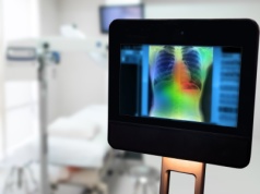 Przełom w diagnostyce raka płuc. AI i roboty wykryją chorobę lata wcześniej