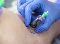 Kot Franek, pijawki, lamy i klauni. Polskie szpitale sięgają po niestandardowe terapie