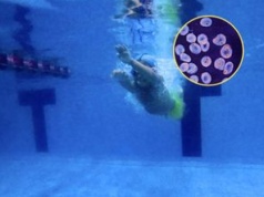 "Zjada mózg".To wyjatkow niebezpieczny mikrooorganizm