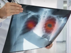 Z lodowiska na onkologię. Były reprezentant kraju wygrywa mecz o zdrowie