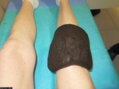 Trzy tygodnie leczenia uzdrowiskowego za darmo. Oto komu przysługuje