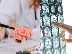 Jest sposób na obniżenie ryzyka demencji. Nawet o 25 proc.