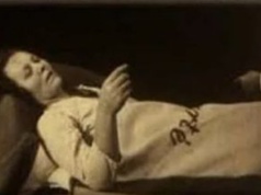 Tajemnicza choroba sprzed wieku. Zabiła 500 tys. osób i zniknęła