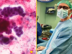 Jak zaczyna się rak? Dr Hać: musi dojść do trzech zdarzeń, zawsze