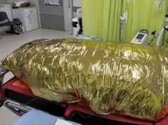 Lekarze z Częstochowy uratowali pacjentkę w stanie głębokiej hipotermii