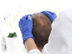 Tradycyjna medycyna chińska w walce z łysieniem androgenowym