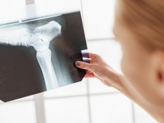 Odczytali, jak ćwiczenia budują mocniejsze kości. Osteoporoza nie ma szans