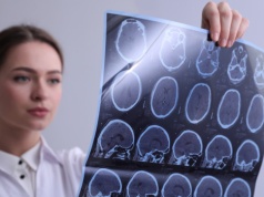 W kilka sekund diagnozuje choroby mózgu. 