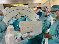 Rewolucja w operacjach kręgosłupa. Lekarzom ze szpitala Copernicus pomaga nowoczesny robot