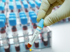 Nowe wytyczne dotyczące cholesterolu już w marcu. Znamy szczegóły