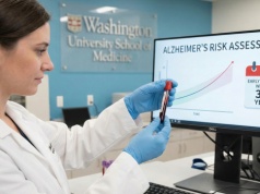 Koniec zgadywania: Proste badanie krwi przewidzi Alzheimera na lata przed pierwszymi objawami