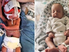 Antoś ważył 620 gramów. Medycy walczyli o niego przez dwa miesiące