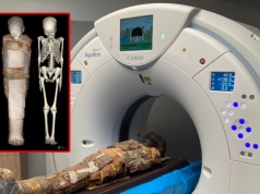 Zagadka tajemniczej mumii z Wrocławia rozwiązana. To ośmioletni chłopiec