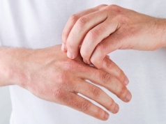 Sposoby na suche ręce zimą. Wybrałam dla was te, które testowałam i działają