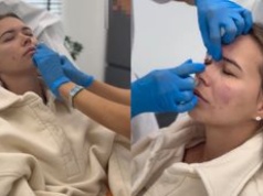 Sandra Kubicka cierpi w imię urody. Zafundowała sobie BOTOKS i nie tylko... Heroska? (WIDEO)