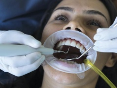 Szokujące ceny u dentystów. Tyle kosztuje leczenie stomatologiczne w 2026 roku