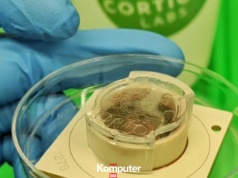 Wyhodowali ludzki mini-mózg. Poradził sobie z zadaniem lepiej od AI