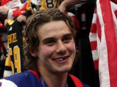 Zdobył złoto, stracił... zęby. Bolesna kontuzja bohatera USA