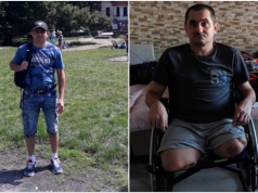 Stracił obie nogi w wypadku podczas pracy. Wsparcie można przekazać rozliczając się z fiskusem
