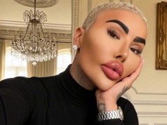 Wydał fortunę na operacje plastyczne. Nagła śmierć "Króla Ust". Zatrzymano dwie osoby