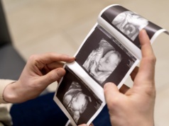 Aborcja to nie „opieka zdrowotna” – przed decyzją KE w sprawie inicjatywy „Mój głos, mój wybór!R …