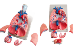 Kryptokokoza – groźna choroba grzybicza