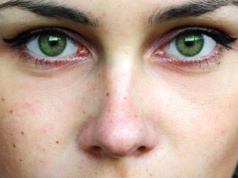 Masz pieprzyk w tym miejscu? To znak, że jesteś wybrańcem losu