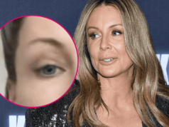 Małgorzata Rozenek-Majdan bez makijażu. Jak naprawdę wygląda cera gwiazdy z bliska?