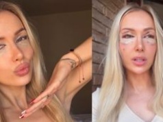 Eliza Trybała poddała się PLASTYCE POWIEK! Zainspirowała się znaną koleżanką: 